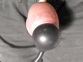 Balloon in the foreskin