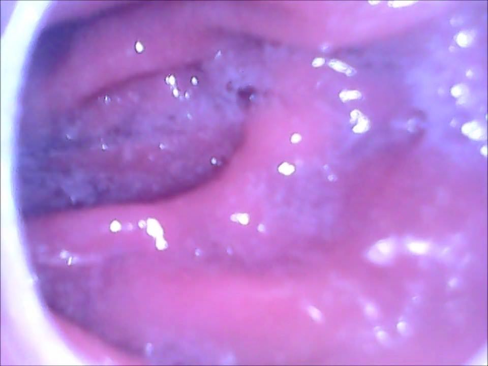 Anal Porn Camera - Endoscope camera inside my ass - Ass for all, Mobiles, Most Viewed -  MobilePorn