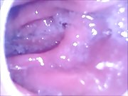 Endoscope camera inside my ass