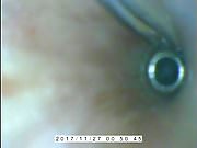 Endoscope E-stim inside Cumming.AVI