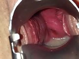 amateur,creampie,doctor