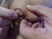 Inserting Circular Piercing In Left Nipple 