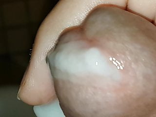 The Lumpy Sperm...