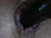 Anal gape