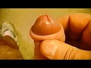 Foreskin upclose 2